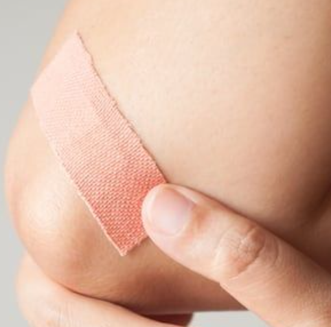 Burns & scrapes healer